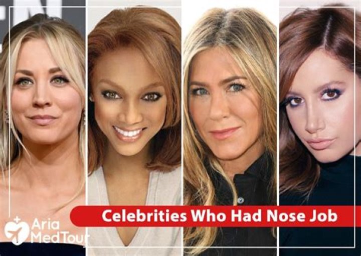 Celebrities Who Got a Nose Job to Fix Their ''Deviated Septum'' E! News
