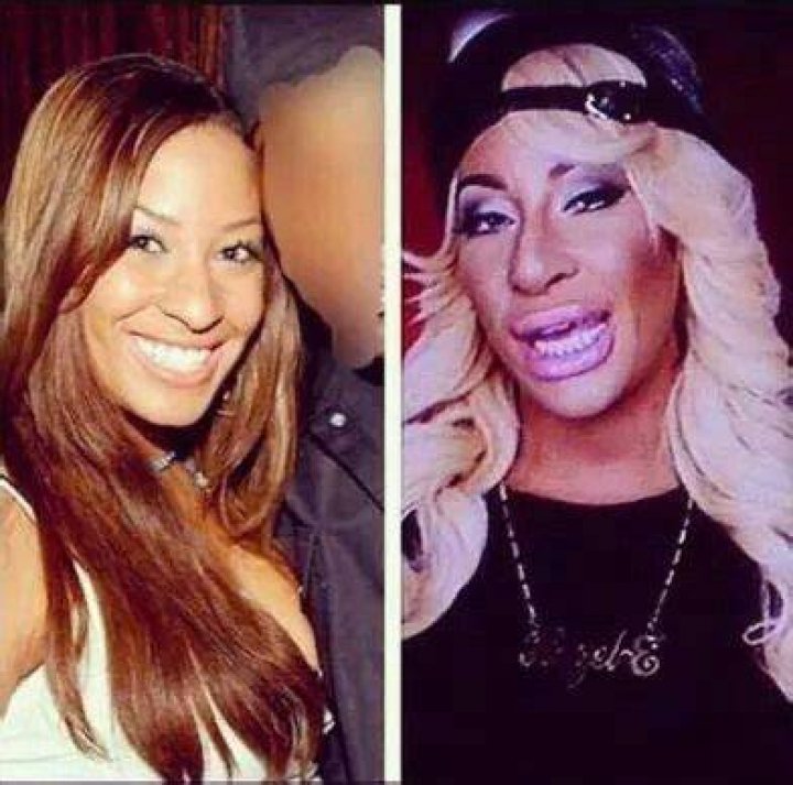Hazel E Before The Surgery